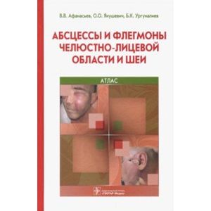 Абсцессы и флегмоны челюстно-лицевой области и шеи