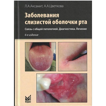 Заболевания слизистой оболочки рта. Связь с общей патологией. Диагностика. Лечение