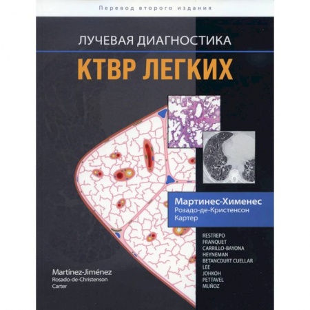 Книги, книга Лучевая диагностика. КТВР легких купить по скидке