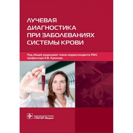УЗИ. ЭКГ. Томография. Рентген, книга Лучевая диагностика при заболеваниях системы крови купить по скидке