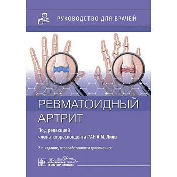 Ревматоидный артрит: руководство для врачей