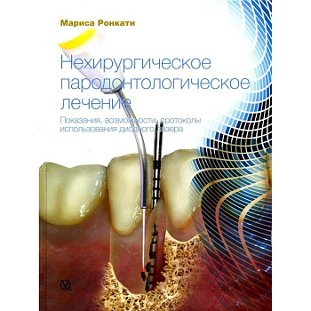 Нехирургическое пародонтологическое лечение. Показания, возможности, протоколы использования диодного лазера