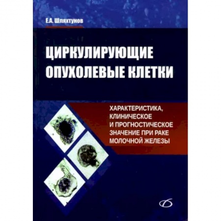 Онкология, книга Циркулирующие опухолевые клетки купить по скидке