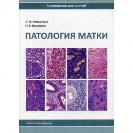Акушерство и гинекология, книга Патология матки. Руководство для врачей купить по скидке